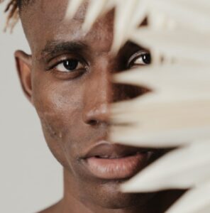 Closeup image of an African American man with acne