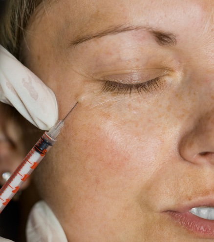 Polynucleotide injections for under eyes - dr derrick phillips