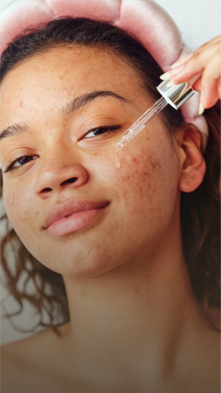 dermatologist approved teenage acne skin care routine