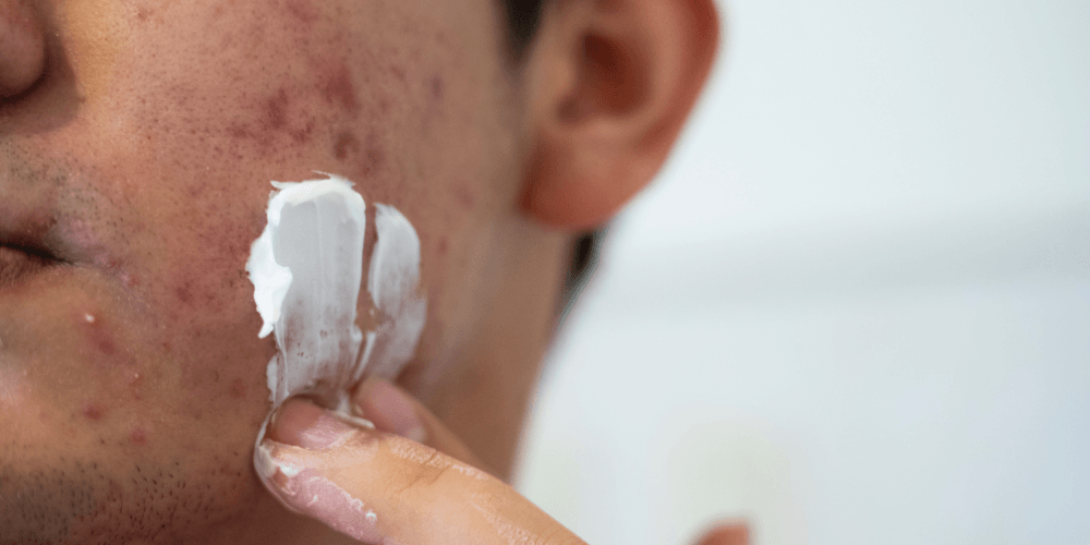 dermatologist recommended ingredients for acne prone skin - dr derrick phillips