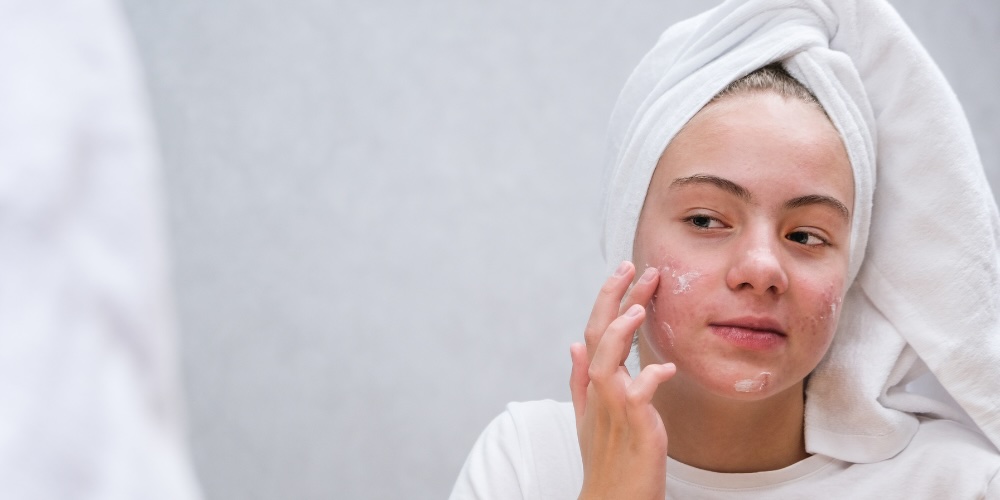 Dermatologist-Recommended Routine for teenage skin care and acne