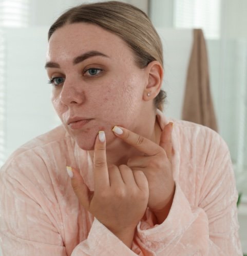 cystic pimple treatment