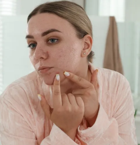 cystic pimple treatment