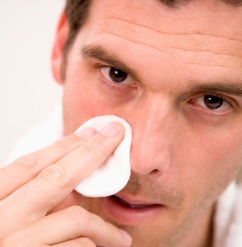 treatment for sebaceous filaments