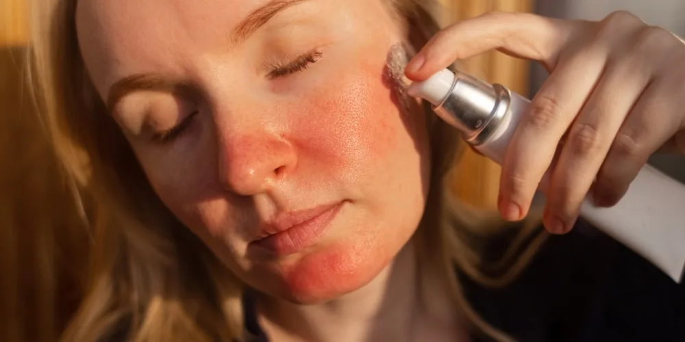 best rosacea treatments ranked by a dermatologist