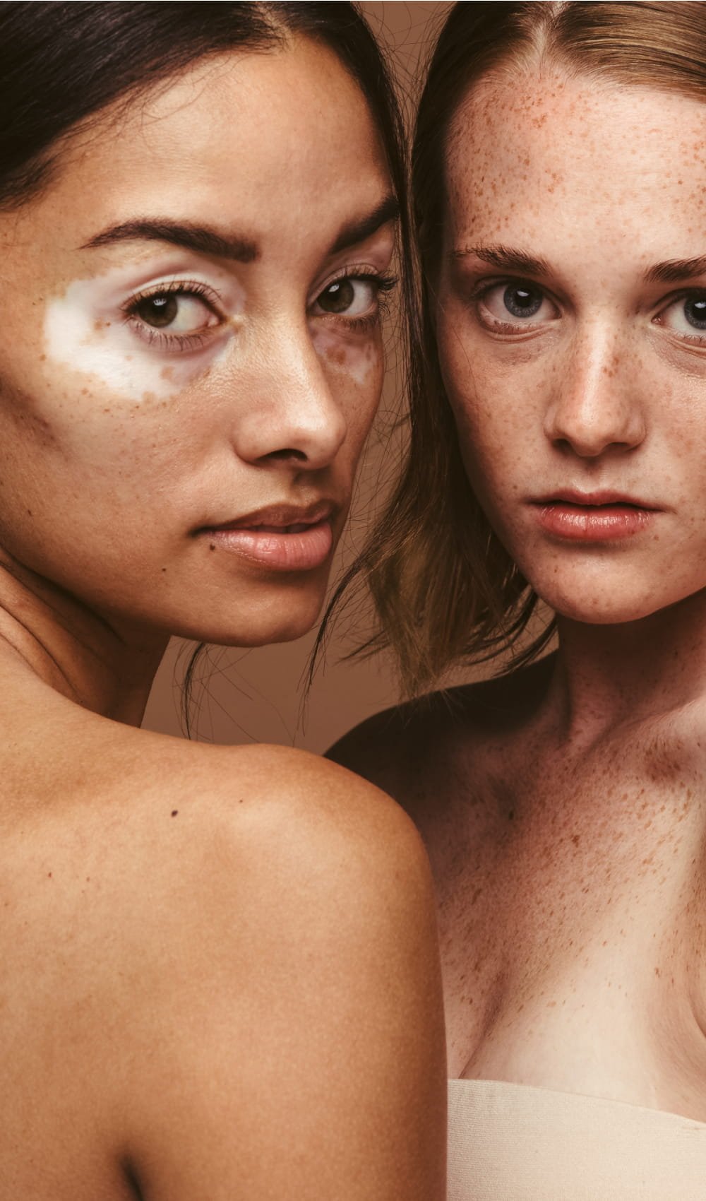 card hyperpigmentation
