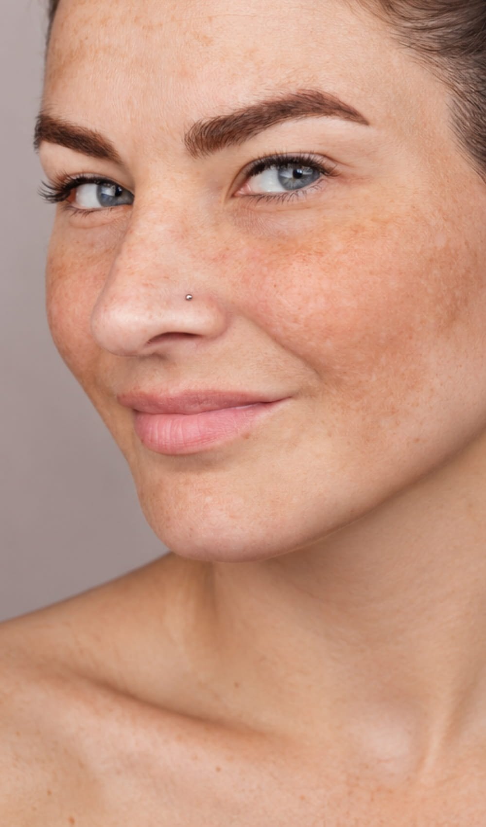card melasma